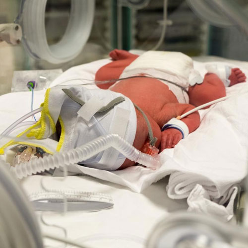 pediatric-icu